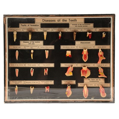 Lot 193 - Wax models of Diseases of the Teeth